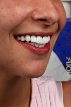 Slider image (5) Bright Way Dental Clinic